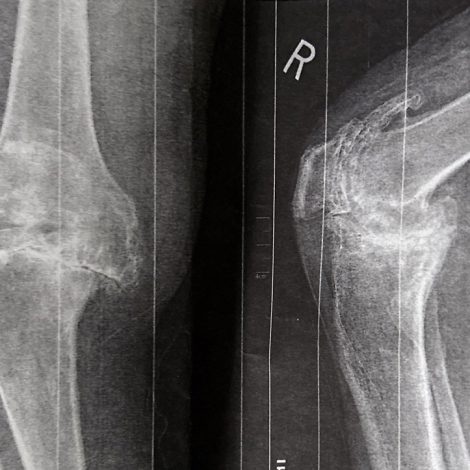 Protected: Clinical Orthopedic Physical Therapy: Knee Pain and Dysfunction with Focus on The Latest Advances in  Knee Arthroplasty.